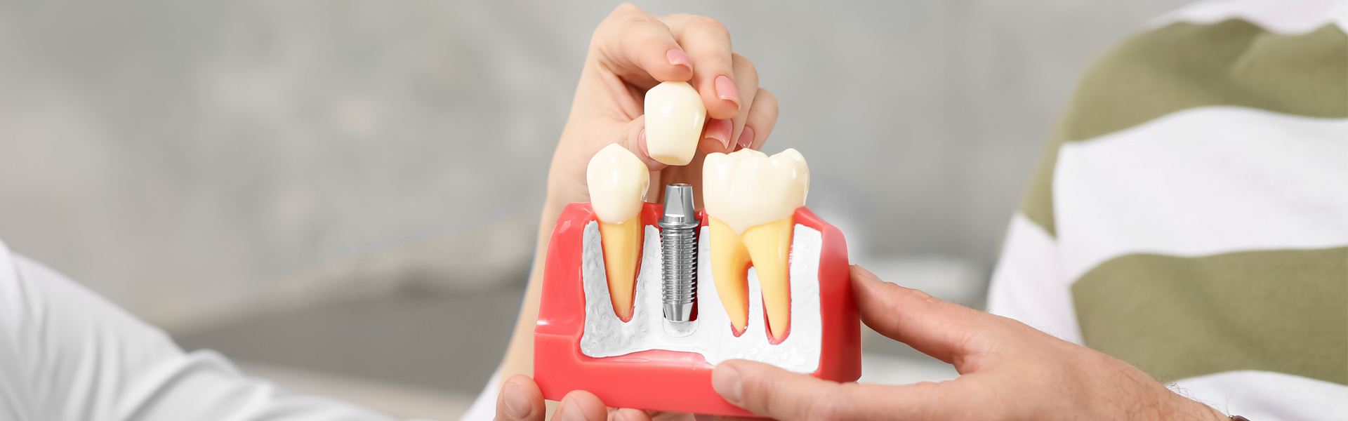 How to Maintain Proper Oral Care With Dental Implants