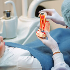 10 Important Facts You Need To Know About Root Canals