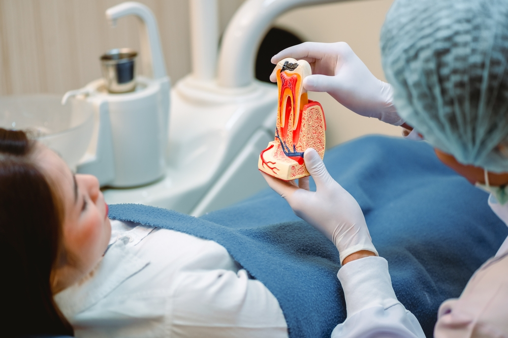 10 Important Facts You Need To Know About Root Canals