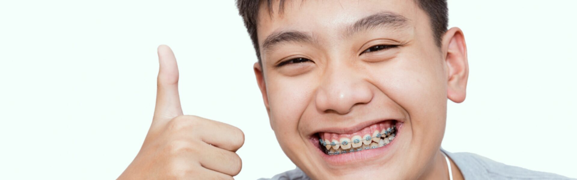Braces (free consultation) in Downtown Toronto